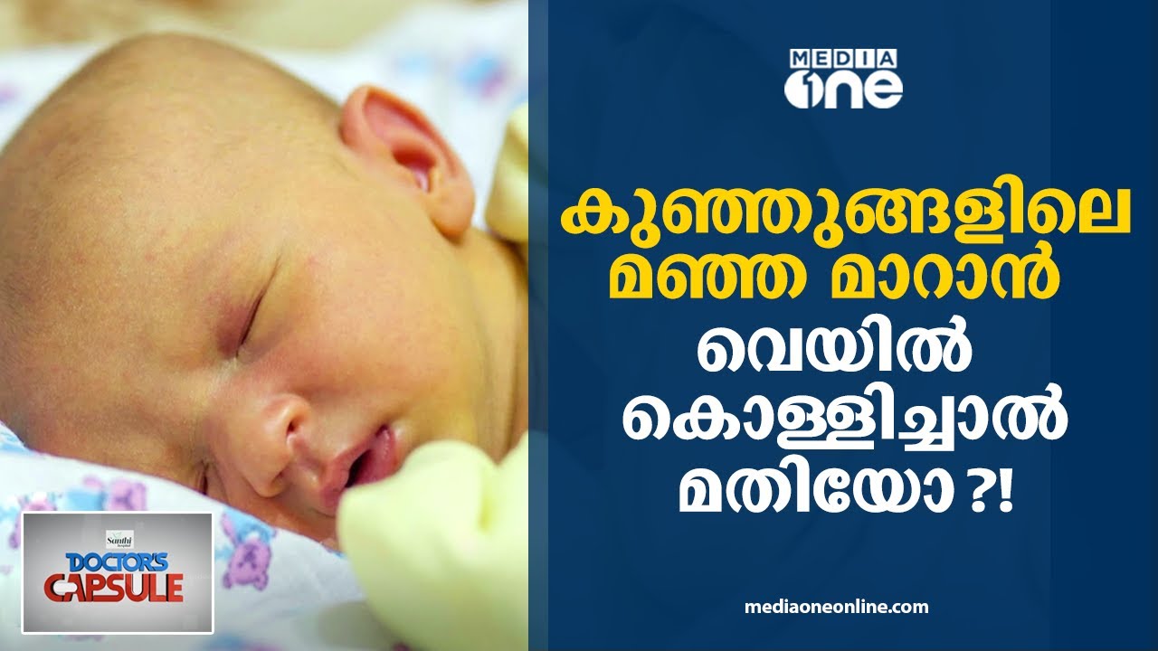 കുഞ്ഞുങ്ങളിലെ മഞ്ഞ മാറാൻ,വെയിൽ കൊള്ളിച്ചാൽ മതിയോ?! | Doctor Capsule