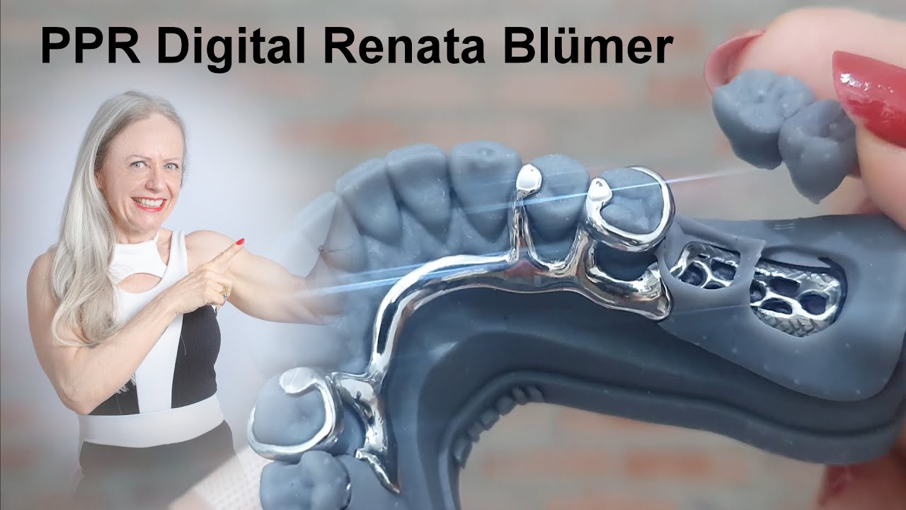 PPR DIGITAL DENTES E GENGIVA - PARTIALCAD EXOCAD RIJEKA 3.1