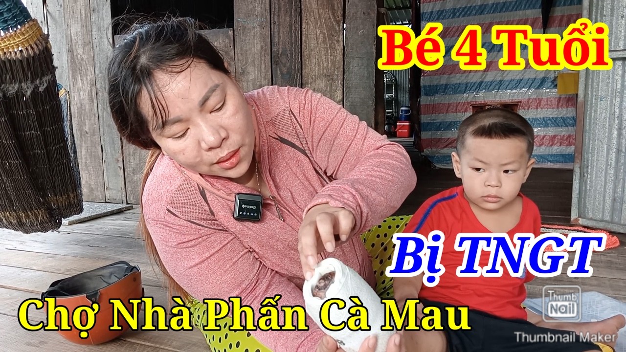 Bé 4 Tuổi BẤT NGỜ Bị TNGT Phải Mổ 4 Lần Vẫn Chưa Lành