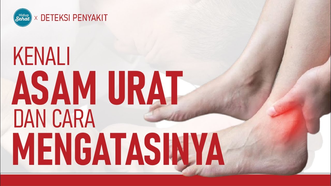 Asam Urat, Gejala dan Cara Pencegahannya! | Hidup Sehat tvOne