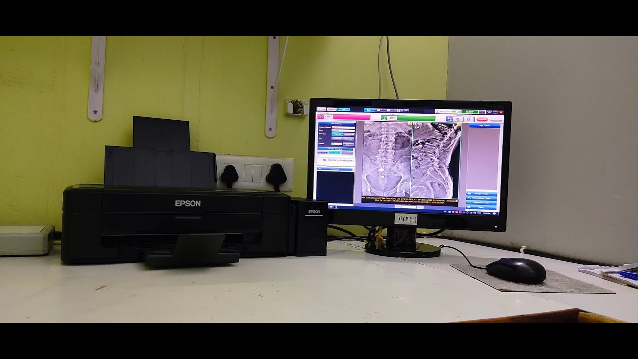 Inkjet X-RAY Film Printing Inkjet Medical Films Low cost x-ray printing how to print x-ray