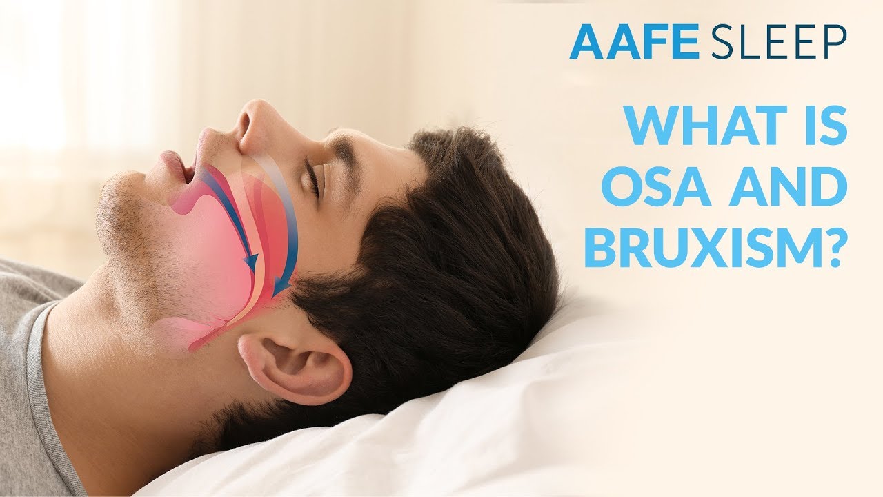 What is OSA and bruxism? | AAFE Sleep