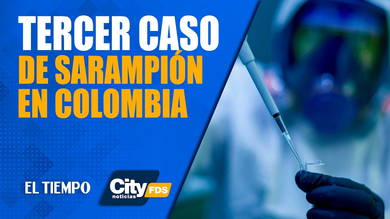 #CityNoticias 28 de febrero: 3 casos de #sarampión confirmados en Colombia