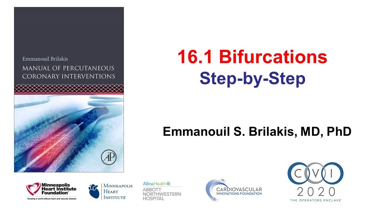 16.1 Bifurcation PCI step-by-step  - Manual of PCI