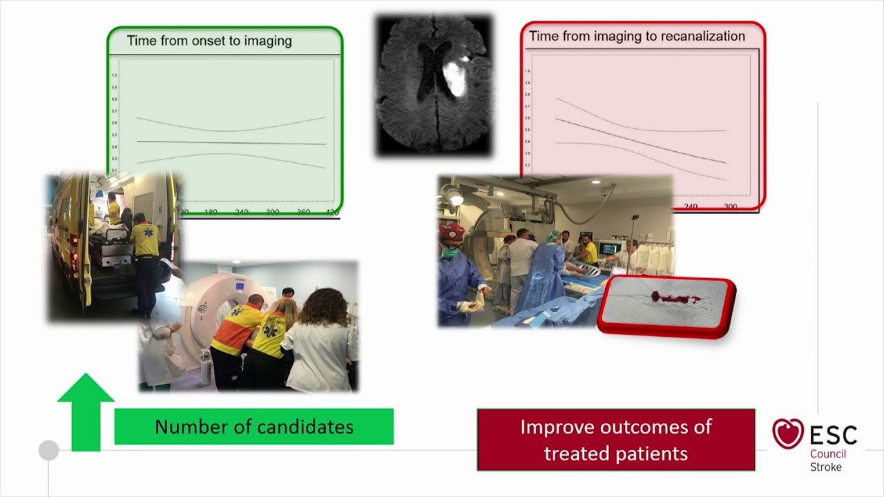 The role of time on ischemic stroke progression - M Rubiera del Fueyo