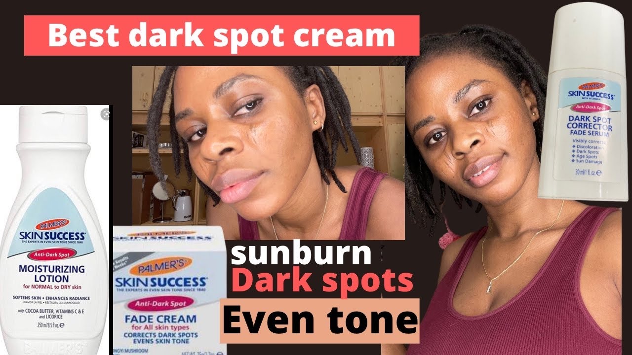 Use palmer’s skin success to Remove Dark spot|Honest review|Does it work?best face cream