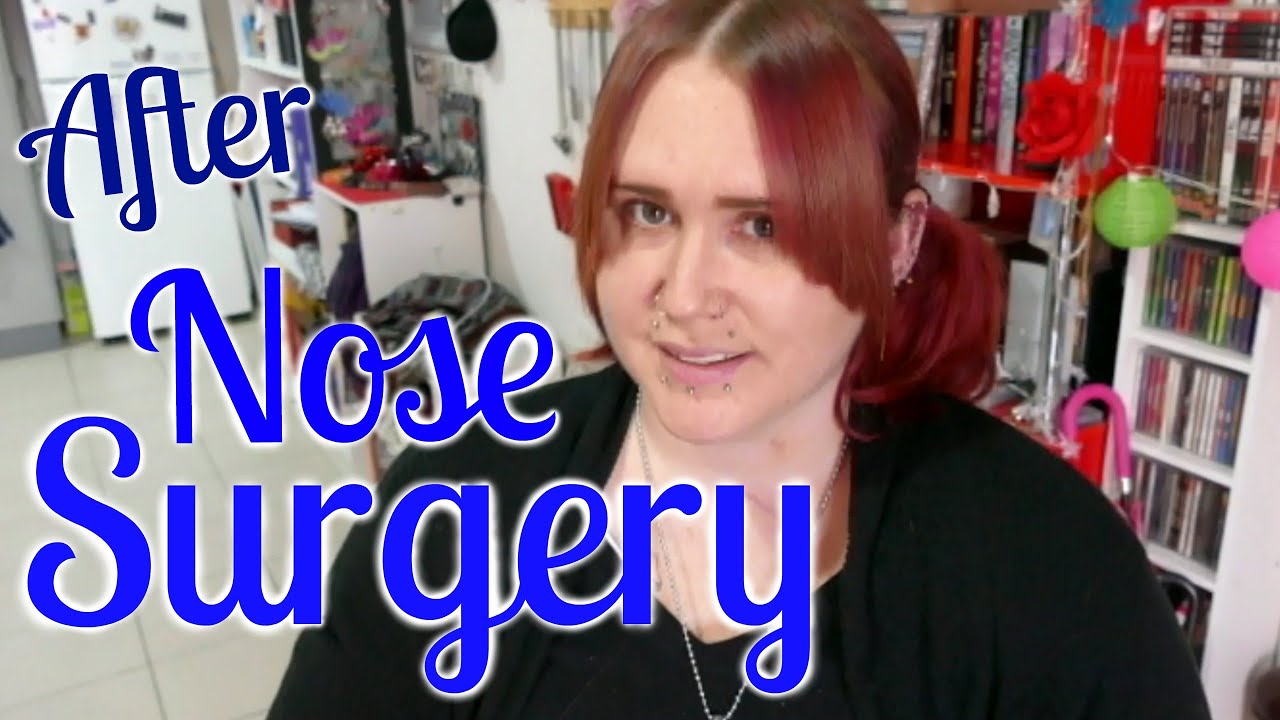 1 Year After Nose Surgery & Removing 48 Piercings For Surgery
