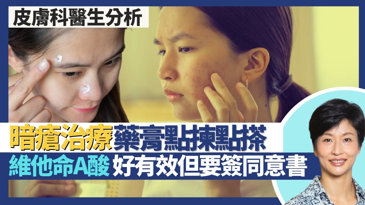 暗瘡治療｜暗瘡膏點揀點搽好 搽錯藥膏隨時皮膚敏感？點預防暗瘡 暗瘡印暗瘡疤痕凹凸洞點醫？維他命A酸同時針對3大暗瘡成因好有效 暗瘡藥都要簽同意書？｜王建芳醫生 皮膚科醫生陳厚毅醫生｜人類健康研究所