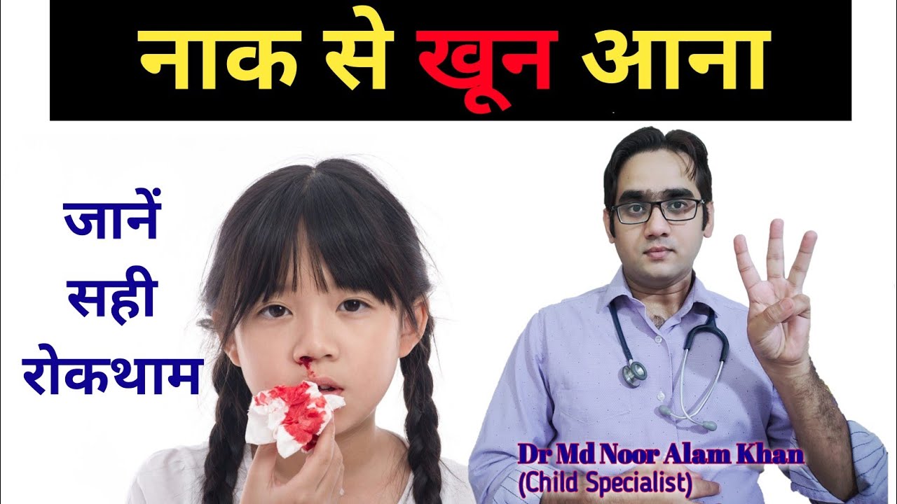 बच्चों की नाक से खून आना | How to stop nose bleeding in Hindi | Epistaxis | Dr Md Noor Alam