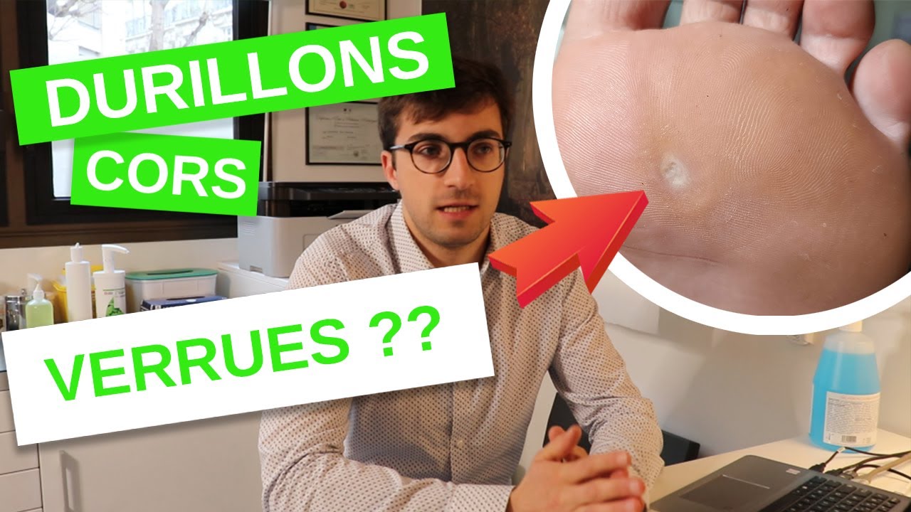 Cor, durillon, verrue... Comment les différencier ?
