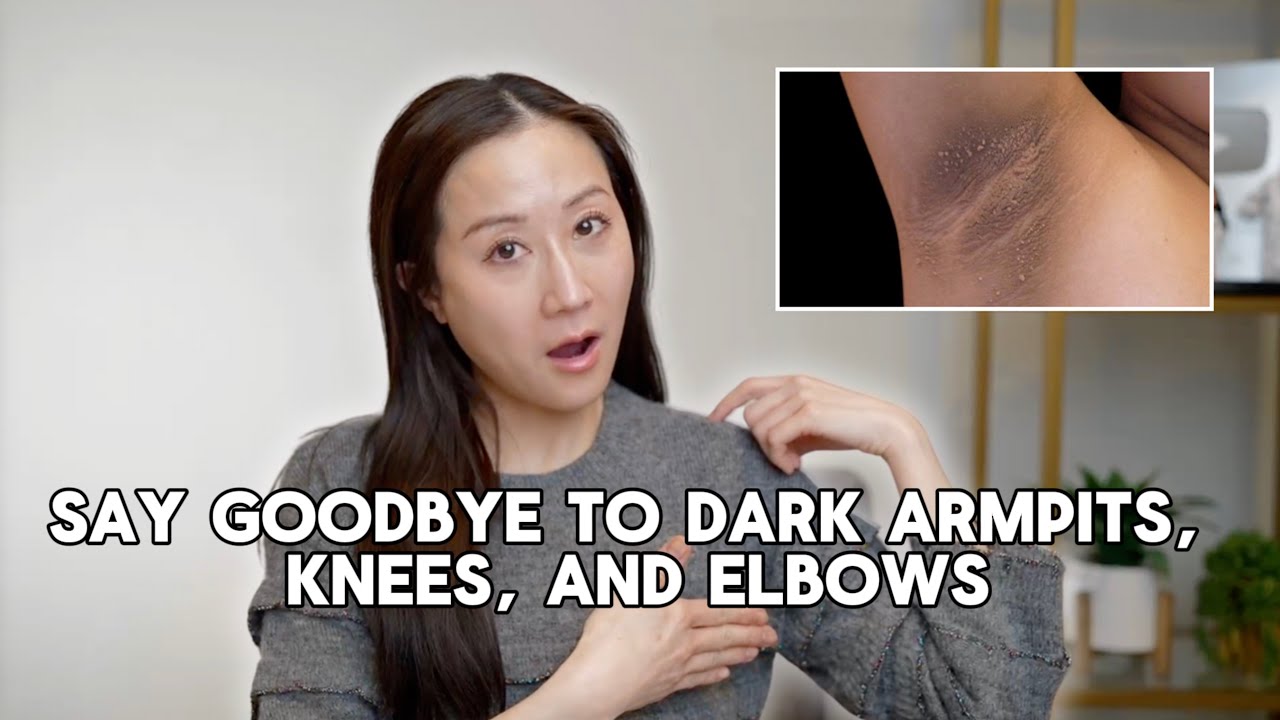 Tips for getting rid of body hyperpigmentation | Dermatologist Dr. Jenny Liu