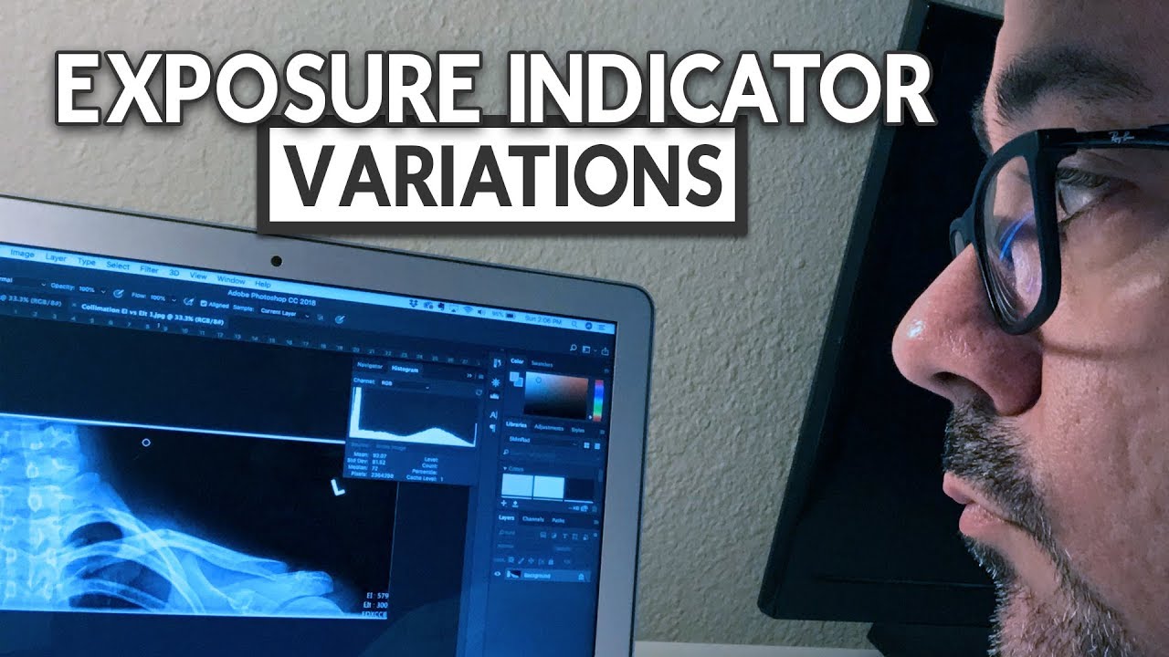 Exposure Indicator Variations