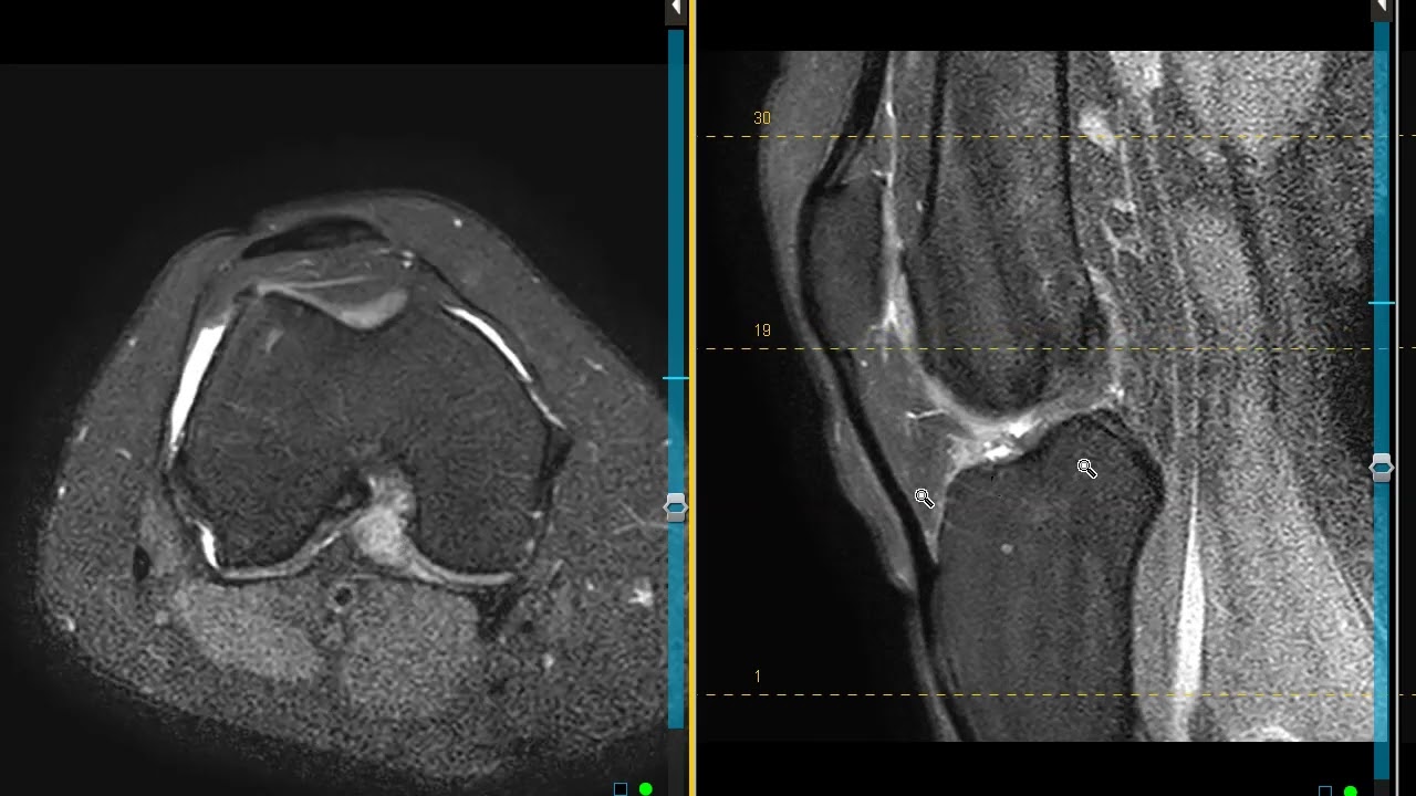 38 year old female with with sharp knee pain
