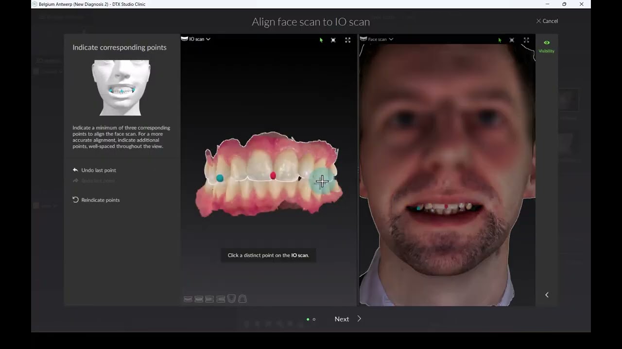 DTX Studio Clinic - Face Scans