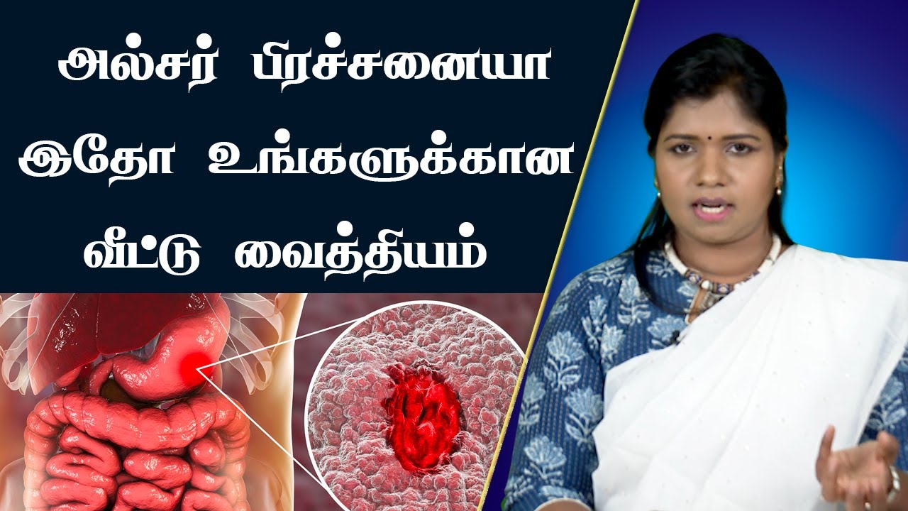 அல்சருக்கு எளிமையான வீட்டு மருத்துவ குறிப்புகள் | Home Remedy for Ulcer | Dr. B.Yoga Vidhya | Tamil