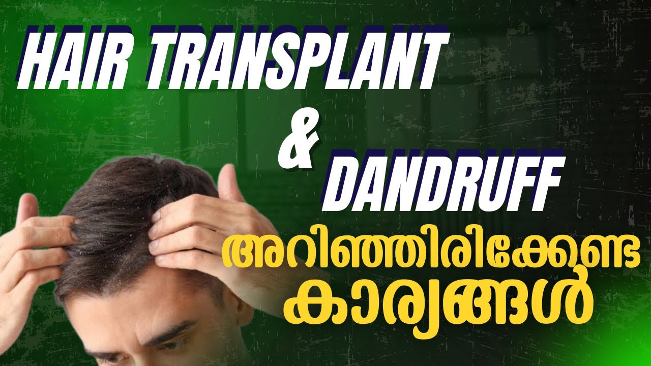 താരൻ കാരണം Hair Transplant റിസൾട്ട് കുറയുമോ ? 🤯 How to control Dandruff Explained ✅
