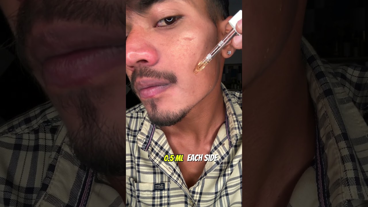 Day 15 Of Using Man Matters Minoxidil 5% for Beard Growth 😉 #beardgrowth #minoxidilresult #viral