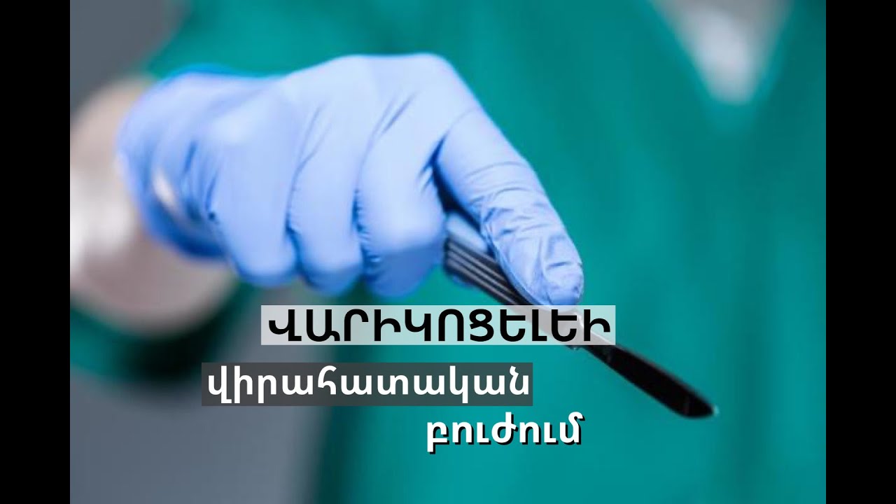 ՎԱՐԻԿՈՑԵԼԵԻ՝ ՄԱՐՄԱՐԻ ՄԵԹՈԴՈՎ ՄԻԿՐՈՎԻՐԱԲՈՒԺԱԿԱՆ ՎԻՐԱՀԱՏՈՒԹՅՈՒՆ