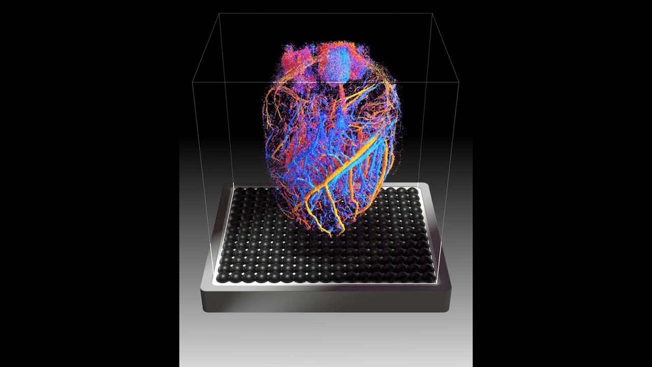 Researchers develop an ultrasound probe capable of imaging an entire organ in 4D
