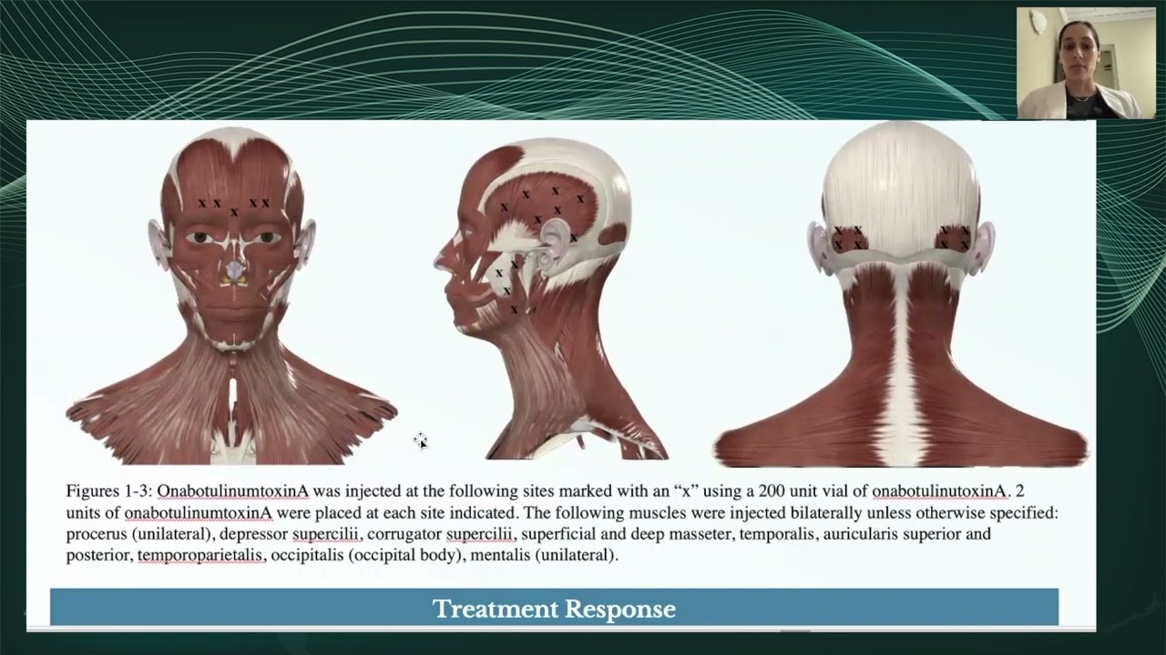 Atypical Vestibular Migraine and Its Response to Various Treatment Modalities: A Case Report