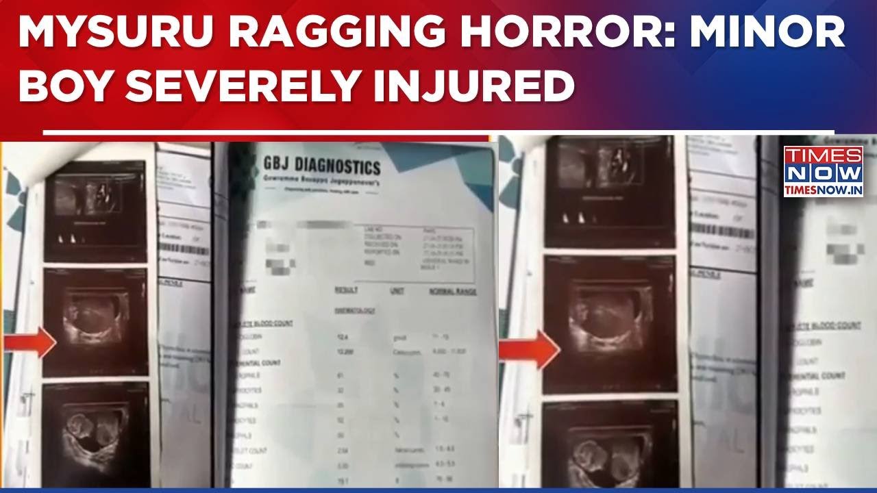 Karnataka Shocker: Minor Boy Severely Injured In Ragging Incident At School In Mysuru| Breaking News