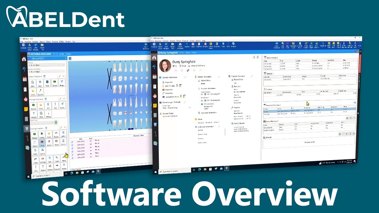 ABELDent Overview