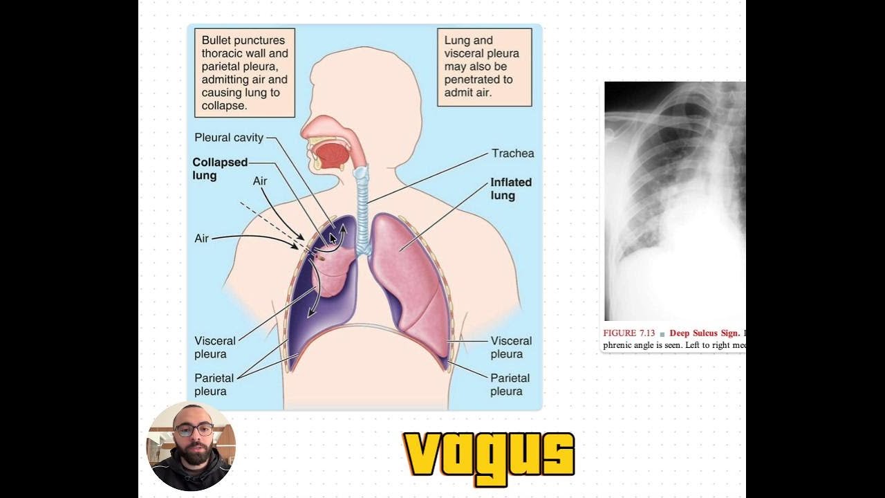 Airway & breathing in trauma