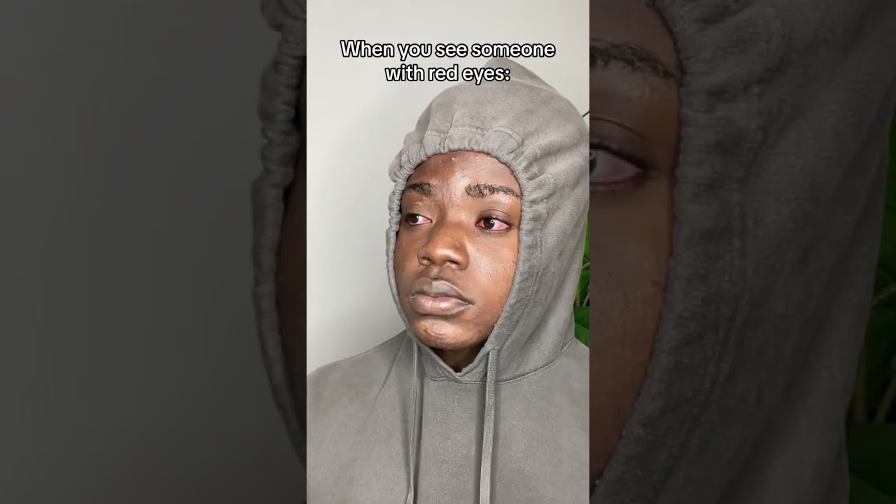 When you see someone with red eyes 😂