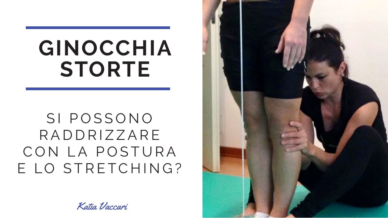 GINOCCHIA STORTE: si possono raddrizzare con la postura e lo stretching?