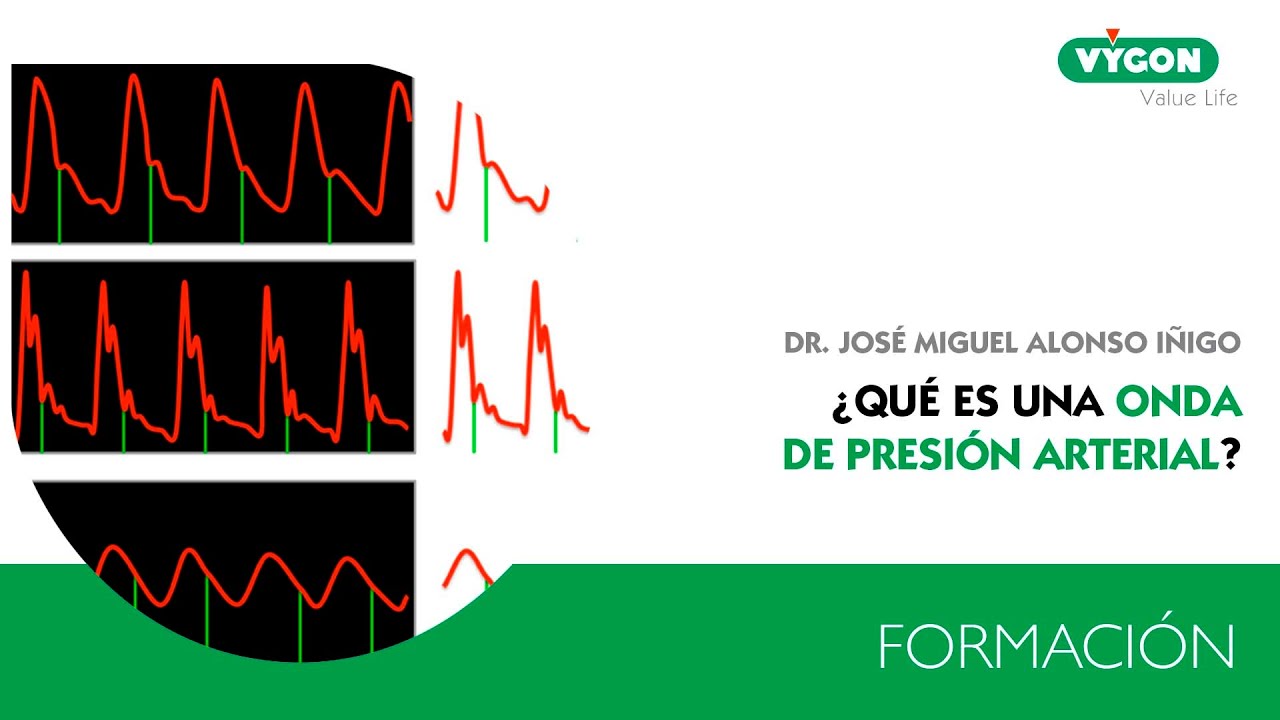 ¿Qué es una Onda de Presión Arterial? (Dr. José Miguel Alonso Iñigo)