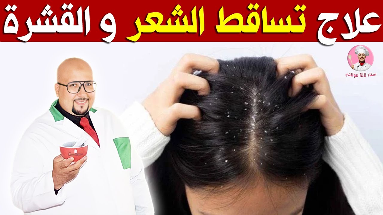 وصفات لعلاج تساقط الشعر والقشرة من عند الدكتور عماد ميزاب | Dr imad mizab | @sanalalamoulati