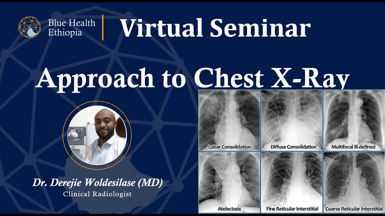 Approach to Chest X-Ray by Dr Derejie Woldesilasie  | Blue Health Ethiopia | Virtual Seminar