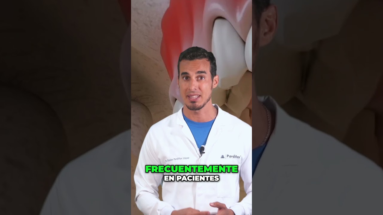 DESGASTE DENTAL - Qu&eacute; es la ATRICI&Oacute;N DENTAL y c&oacute;mo SOLUCIONARLA