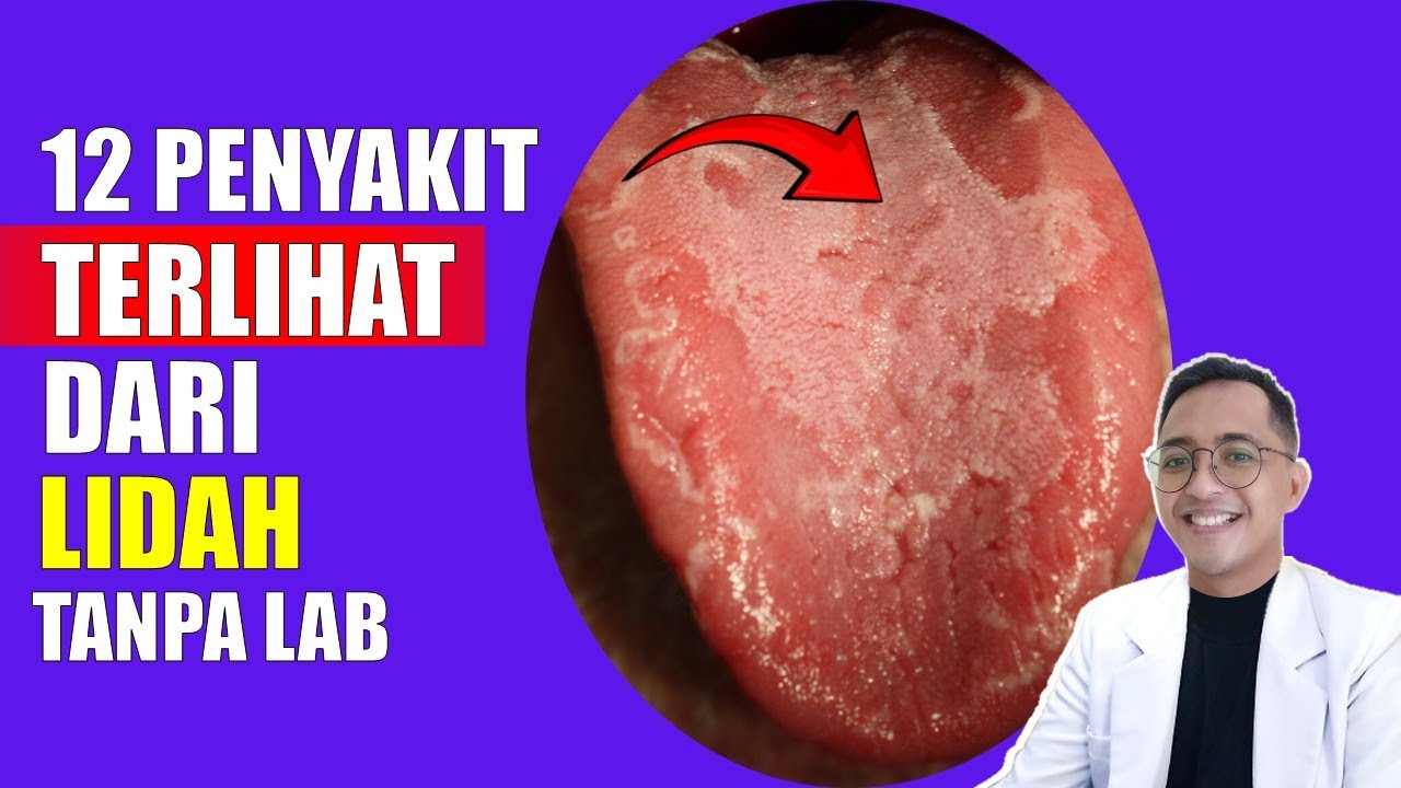 Cek Lidah Sekarang! Inilah yang Lidah Ungkapkan Tentang Jantung, Hati, dan Ginjal Anda