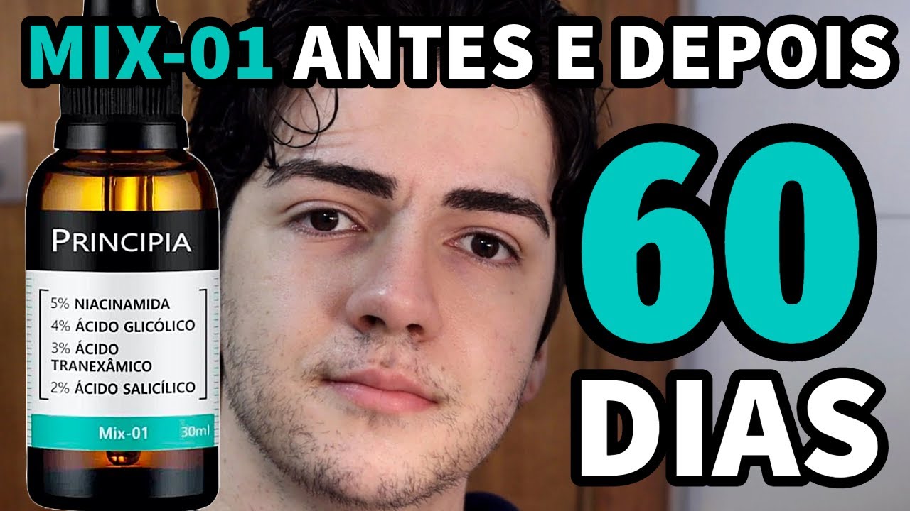MIX-01 60 DIAS DE USO ANTES E DEPOIS Principia Skincare Niacinamida Ácido Glicólico Ácido Salicílico