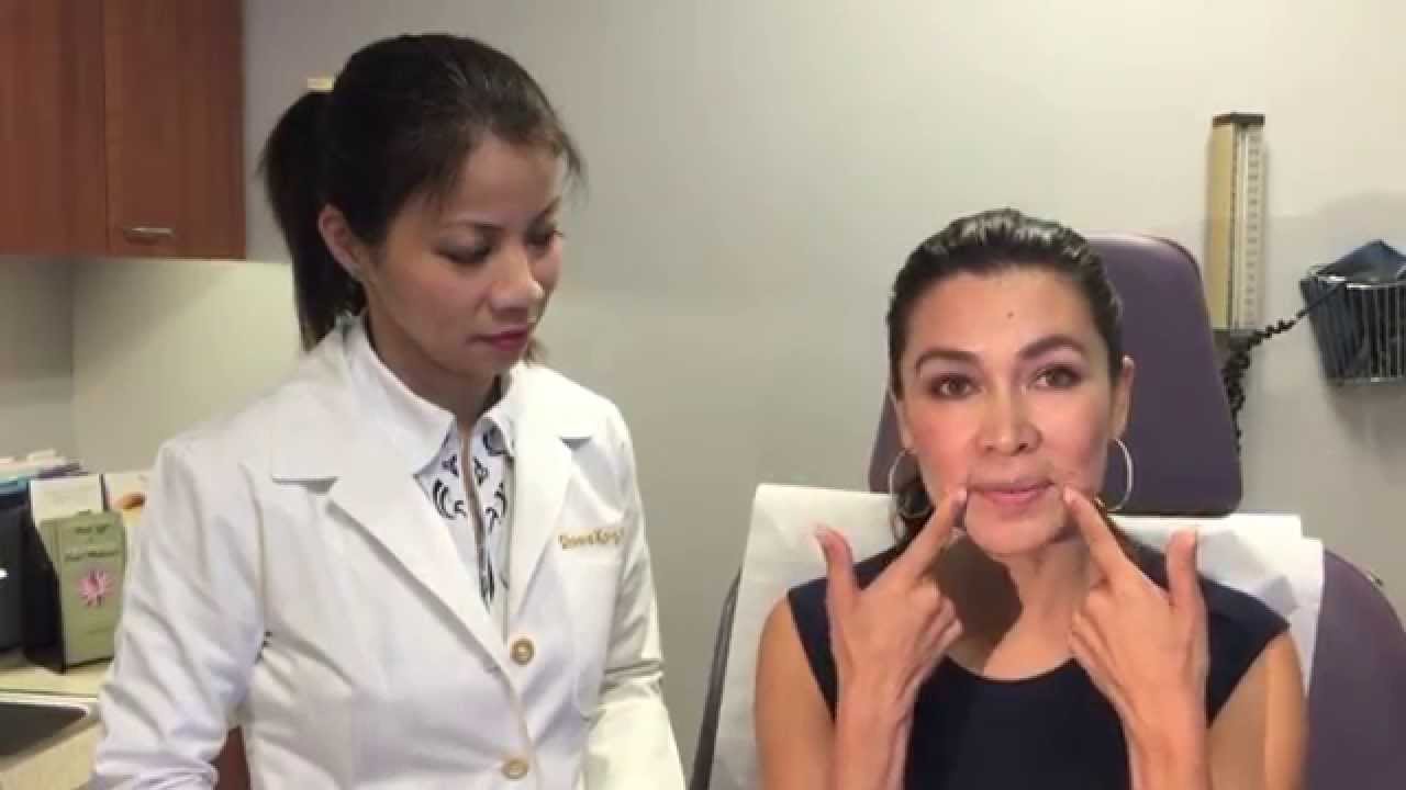 Watch Voluma Filler Enhance San Francisco Woman's Cheeks In Minutes
