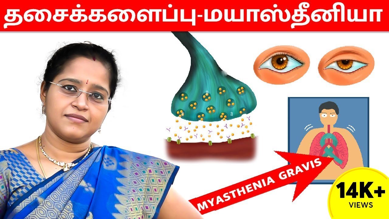 தசைக்களைப்பு-மயாஸ்தீனியா | Myasthenia Gravis | Dr. A.VENI | RockFort Neuro Centre | Trichy