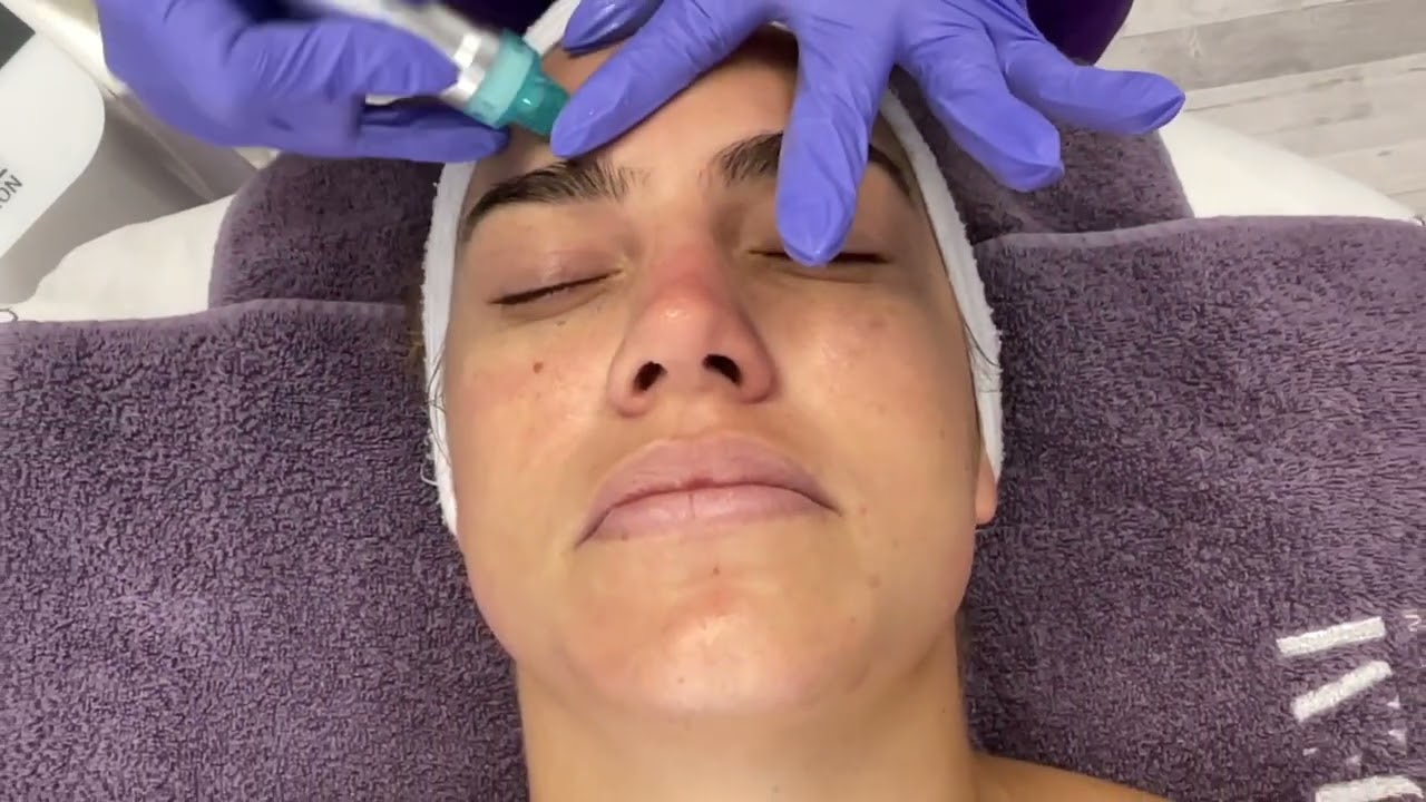 DermaJem Hydrodermabrasion + M.A.D Skincare Hydro Kit Demonstration
