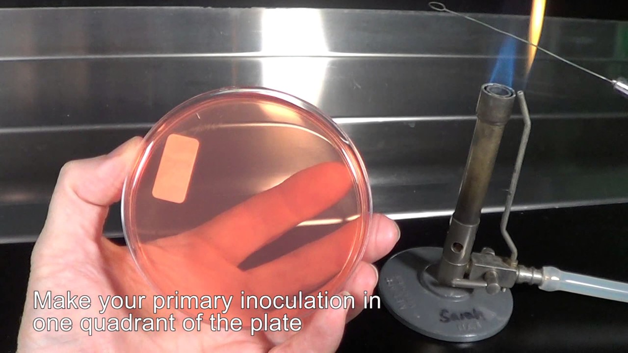 Streaking for single colonies