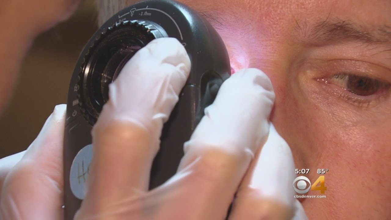 RV Travels To Littleton For Free Skin Cancer Screenings