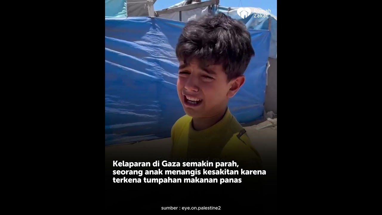 Kelaparan di Gaza Semakin Parah, Seorang Anak Menangis Kesakitan