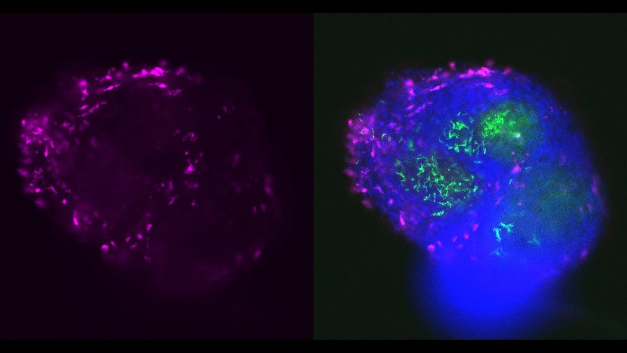 New Way to Study Tuberculosis
