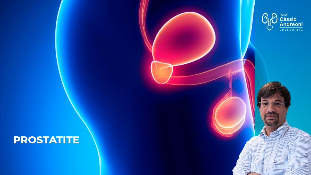 Prostatite: Causas, Sintomas, Exames e Tratamentos.  | Dr. Cassio Andreoni CRM 78.546