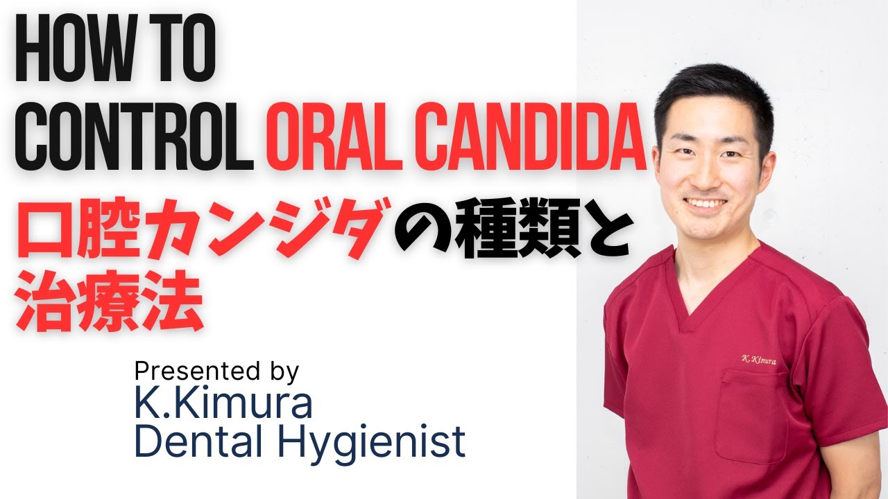 （字幕付：with English subtitle)口腔カンジダ症についてざっくり解説します。'Oral candida' characteristics and treatment.