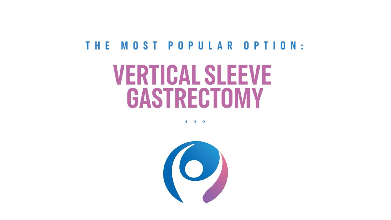 The Most Popular Option - Vertical Sleeve Gastrectomy