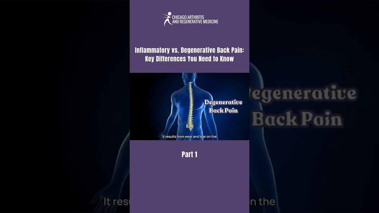 Inflammatory vs. Degenerative Back Pain: Key Differences You Need to Know 💡 | PART 1