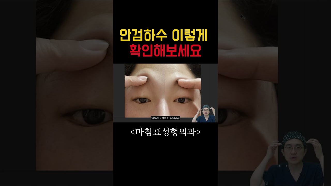 안검하수 이렇게 확인해보세요 #쇼츠