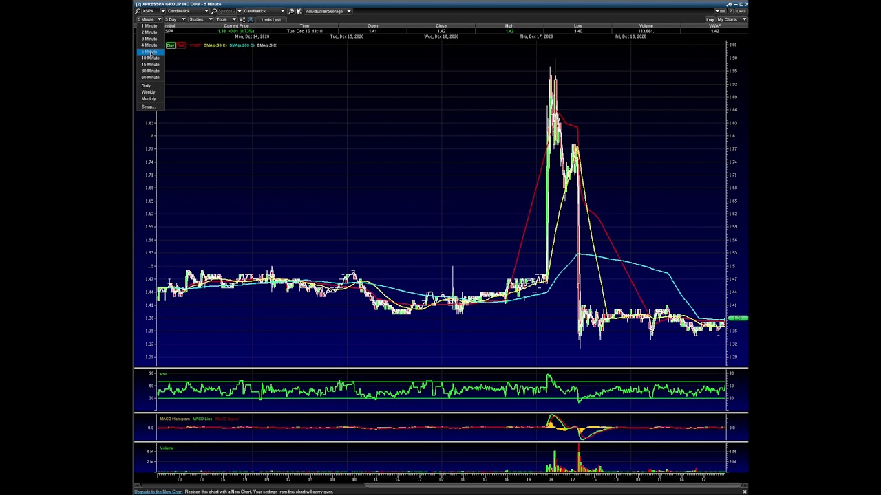 XSPA Stock Analysis
