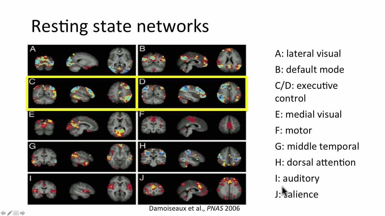 MRI Imaging of Dementias