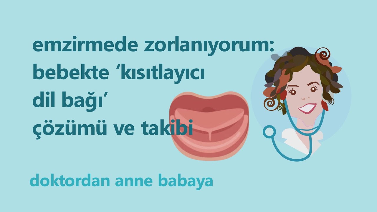 Bebekte ‘dil bağı’  varsa çözümü ve takibi...